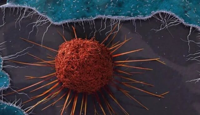 Parasitic infection may trigger cancer in cervix after treatment: Study