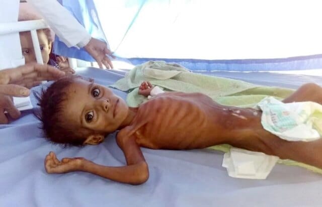 UN warns of looming famine in Yemen UN warns of looming famine in Yemen